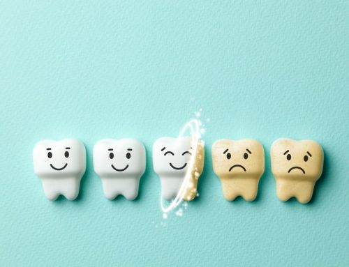 How to Fix Yellow Teeth Quickly and Safely